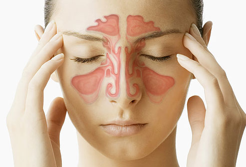 Sinusitis (Sinus Infection) Feature Image